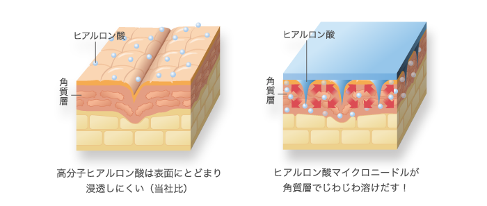 肌浸透のメカニズム